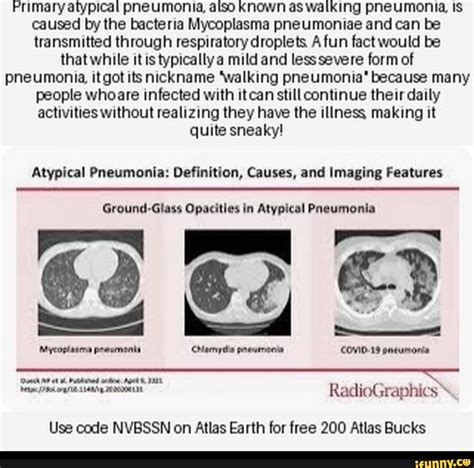 Primary Atypical Pneumonia Also Known As Walking Pneumonia Is Caused By