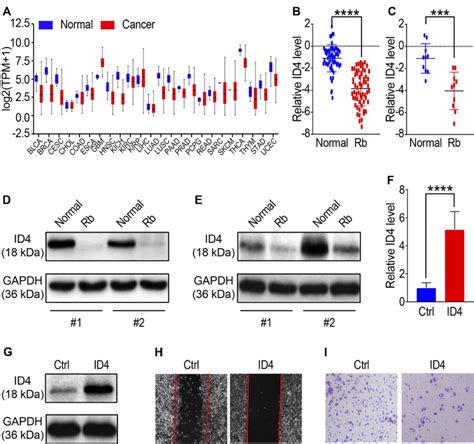 ID4 Promotes Retinoblastoma Proliferation A The Level Of The ID4 In