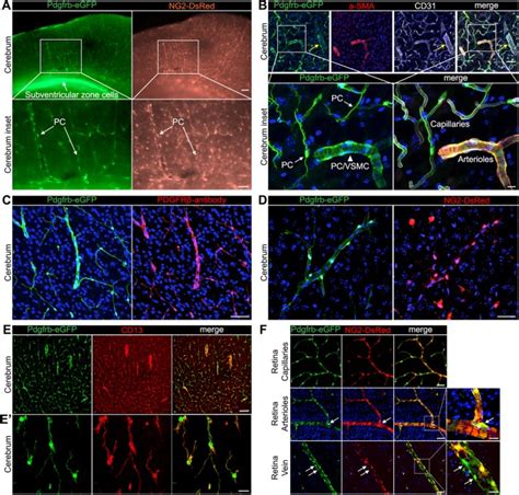 Analysis Of The Brain Mural Cell Transcriptome Scientific Reports