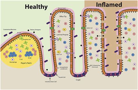 Frontiers Epithelial Mhc Class Ii Expression And Its Role In Antigen