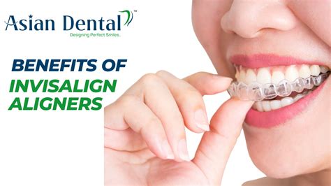 Asian Dental Vijayawada Benefits Of Invisalign Aligners Over