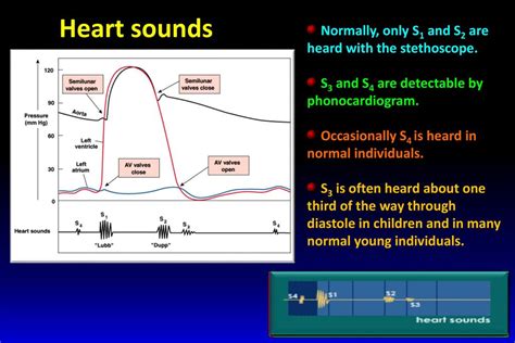 Heart Sounds Diagram S S