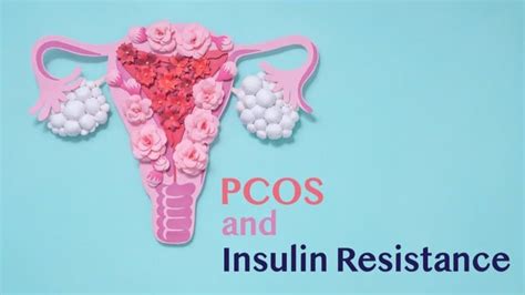 Know The Link Between Pcos And Insulin Resistance Sugarfit