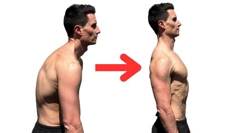 10 Minute Workout To Fix Bad Posture Youtube