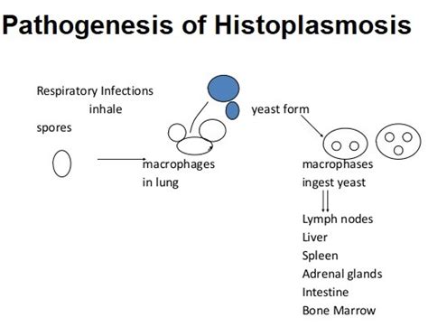 Histoplasmosis: Symptoms, Pathogenesis, Treatment and Prevention