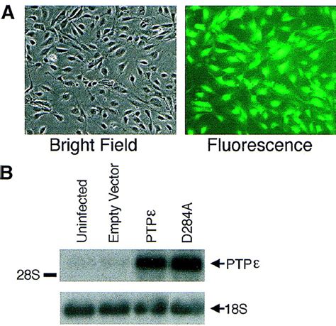 Ptp A Tyrosine Phosphatase Expressed In Endothelium Negatively