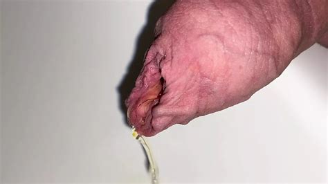 Foreskin Pissing And Cumshot Dutch Gay Amateur Amateur Porn XHamster