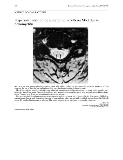 (PDF) Hyperintensities of the anterior horn cells on MRI due to poliomyelitis