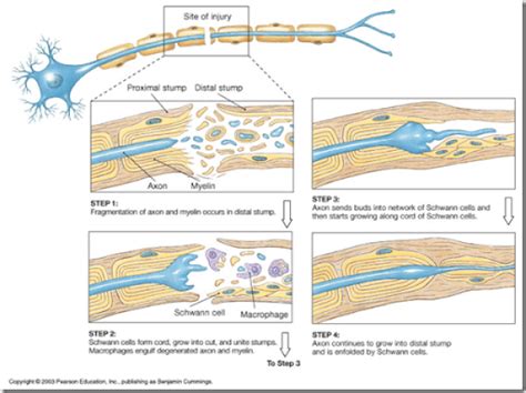 Degeneration And Regeneration Of Peripheral Nerves