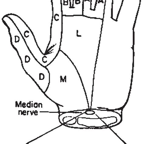 Topography Of The Median Nerve At The Level Of The Radial Styloid A