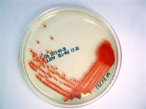 Serratia Marcescens On TSA Agar Mostly Harmless Flickr