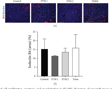 Figure From Human Umbilical Cord Perivascular Cells Prevent Tumor