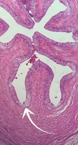 Histology- Epithelial Tissue slides Flashcards | Quizlet