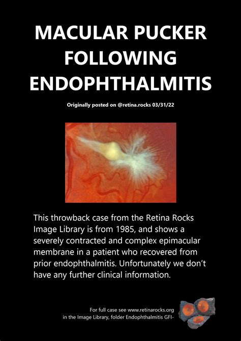 Vitreous, Vitreoretinal Interface Abnormalities, and Peripheral Retina