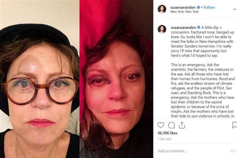 Actress Susan Sarandon shocks fans with photos of her bruised face ...