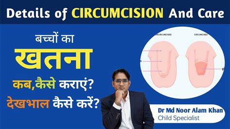 Circumcision In Hindi खतनाकब कहां कैसे कराएं खतने के बाद देखभाल Dr Md Noor Alam Youtube