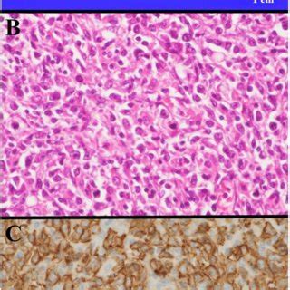 Pathological Assessment Macroscopic Findings Are Shown A