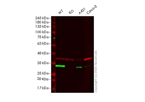 Recombinant Anti Carbonic Anhydrase Ca Antibody Epr Ko Tested