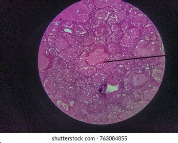 Stoma Under Microscopeleaf Under Microscopeorganproducing Oxygen Stock ...