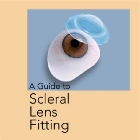 Scleral Lens Fitting Process Michigan Contact Lens