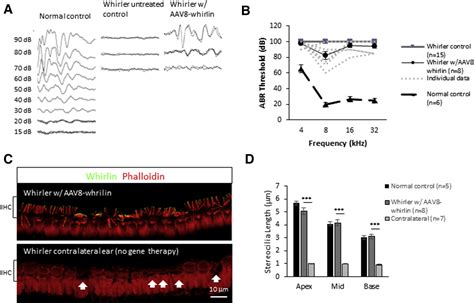 Gene Therapy Restores Balance And Auditory Functions In A Mouse Model