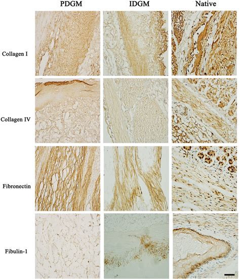 Immunohistochemical Detection Of ECM Components In Biomaterial Meshes