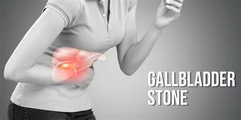 Gall Bladder Stone Symptoms