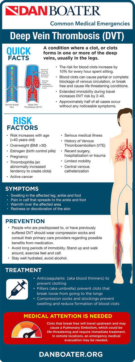 Important Facts About Deep Vein Thrombosis For Travelers, 57% OFF