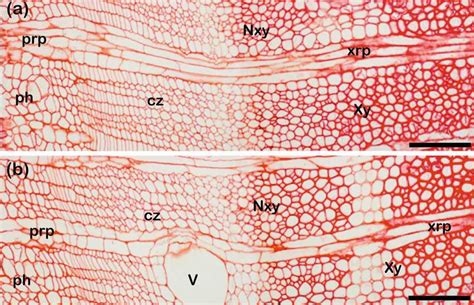 Light Micrographs Of Transverse Images Of Phloem Cambium And Xylem Of