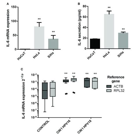 Evaluation Of Il 6r Expression In Cell Lines And Cervical Tissues