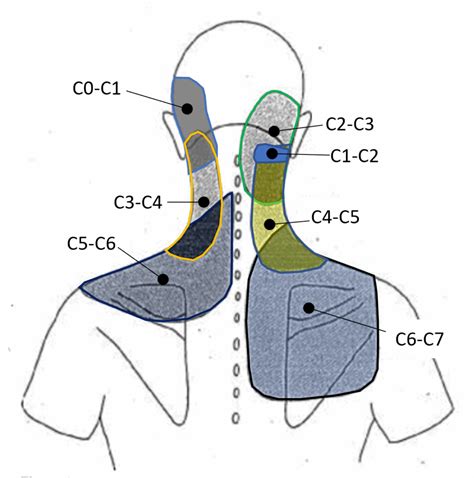 Lumbar Facet Joint Referral Pain | Hot Sex Picture