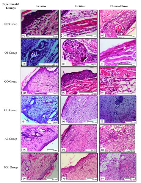 Microscopic Histology Images On Day 9 A Inflammatory Infiltrate In Download Scientific