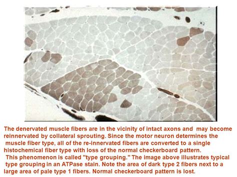 The Image Above Illustrates An Nadh Tr Stain Showing Dark Type And