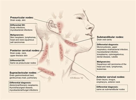 Swollen Cervical Lymph Nodes Back Of Neck Tolfengine