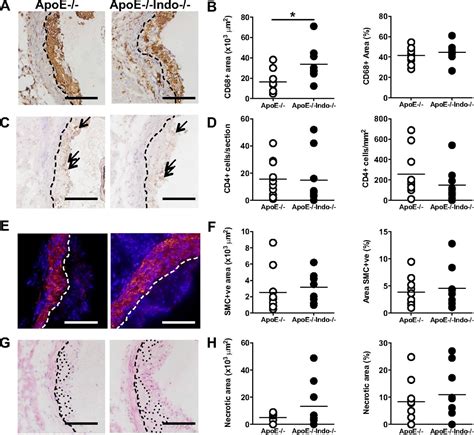 Indoleamine Dioxygenase Is Protective In Atherosclerosis And Its