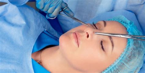 Rhinoplasty Procedure Steps Steps Of Nose Surgery Mediranco