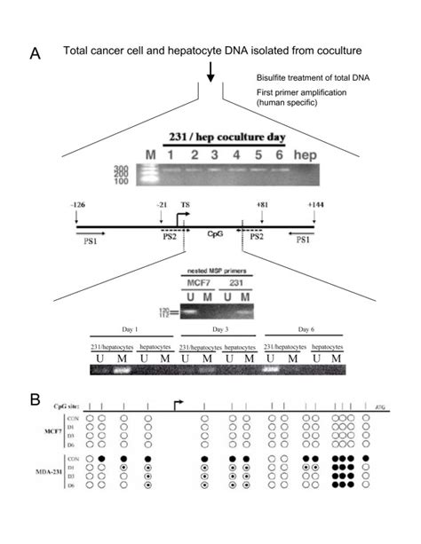 Breast Cancer Cells Lose Methylation Of E Cadherin Promoter Methylation