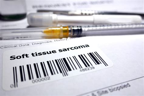 Soft Tissue Sarcomas How To Recognize The Symptoms Uhealth Collective