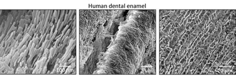 Tooth Enamel Structure