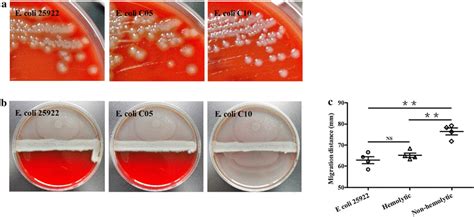 Proteus -bacterium- - sanyra