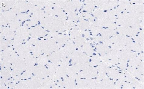 Anti α Dystroglycan Antibody Clone 3o19 H1 Zoomab® Rabbit Monoclonal