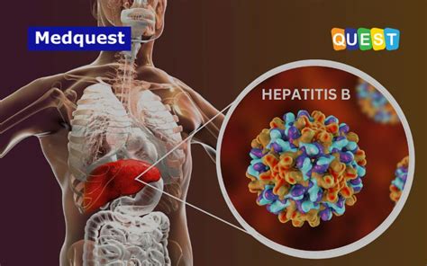 Hepatitis B Kenali Penyakitnya Cegah Penularannya