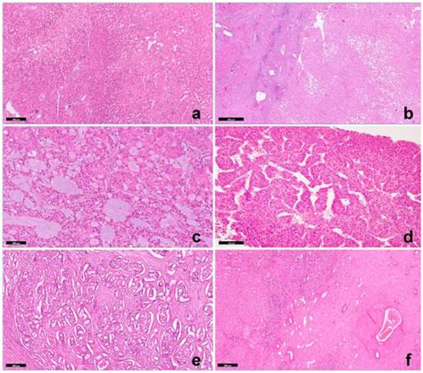 Cancers Free Full Text Histopathological Spectrum And Molecular