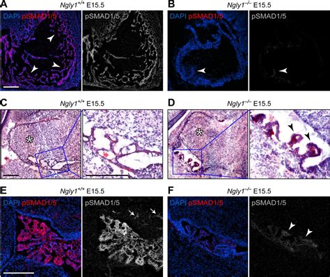 Regulation Of Bmp Dpp Retrotranslocation And Signaling By