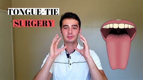 Tongue Tie Release Lingual Frenectomy Was It Worth It Youtube