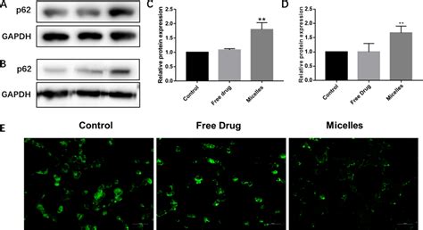 The Blockade Of Autophagic Flux AD Western Blot Of The P62