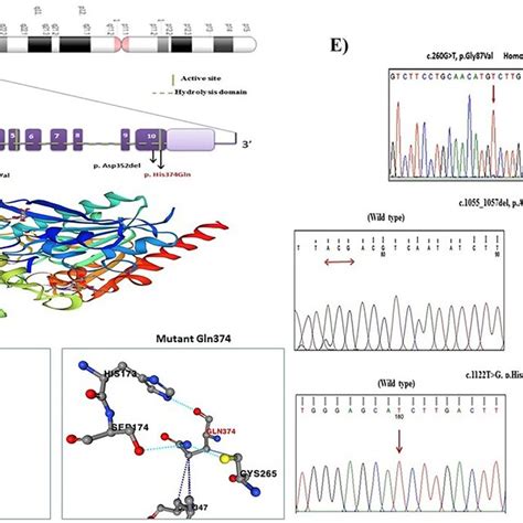 A Location Of The Lipa Gene On Chromosome Q Q B Diagram Of