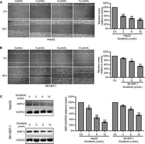 Effect Of Sorafenib On The Motility And MMP 2 Expression Of HepG2 And