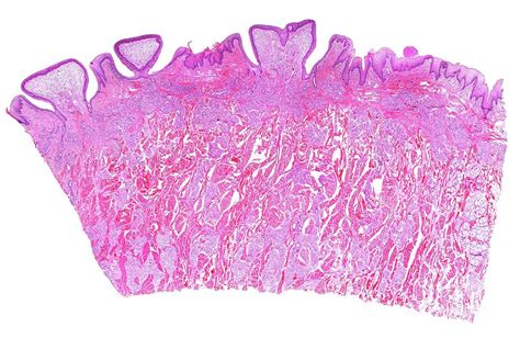 Vallate Papillae Of Human Tongue Photograph By Jose Calvo Science