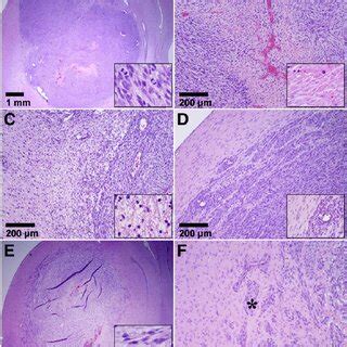 Appearance of 9L gliosarcoma in the three control groups in histology ...